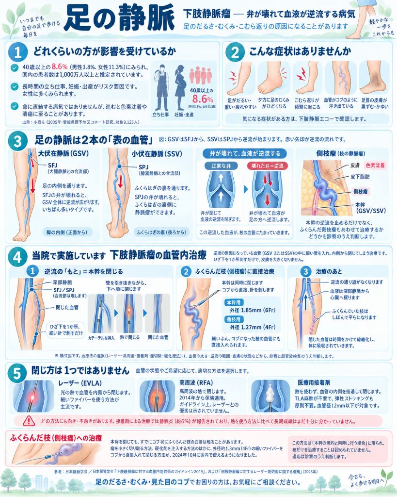 下肢静脈瘤の解説